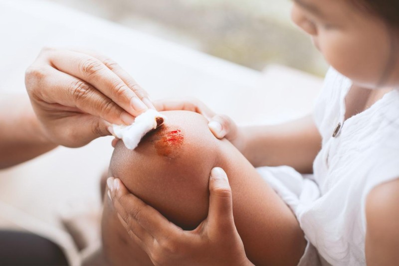 bị vết thương hở có uống trà sữa được không