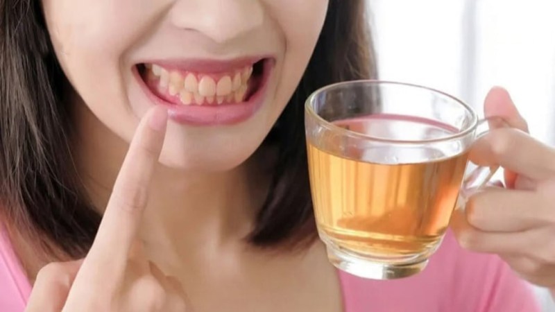 uống trà có làm vàng răng không